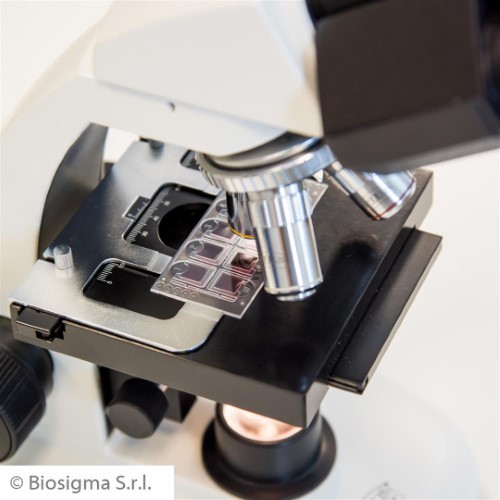 Biosigma Fast-Read 102 vetrini urine 10 camere 7 µL