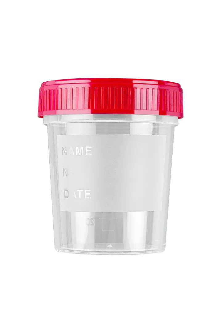 FL Medical Promed contenitore urina 120 ml tappo a vite