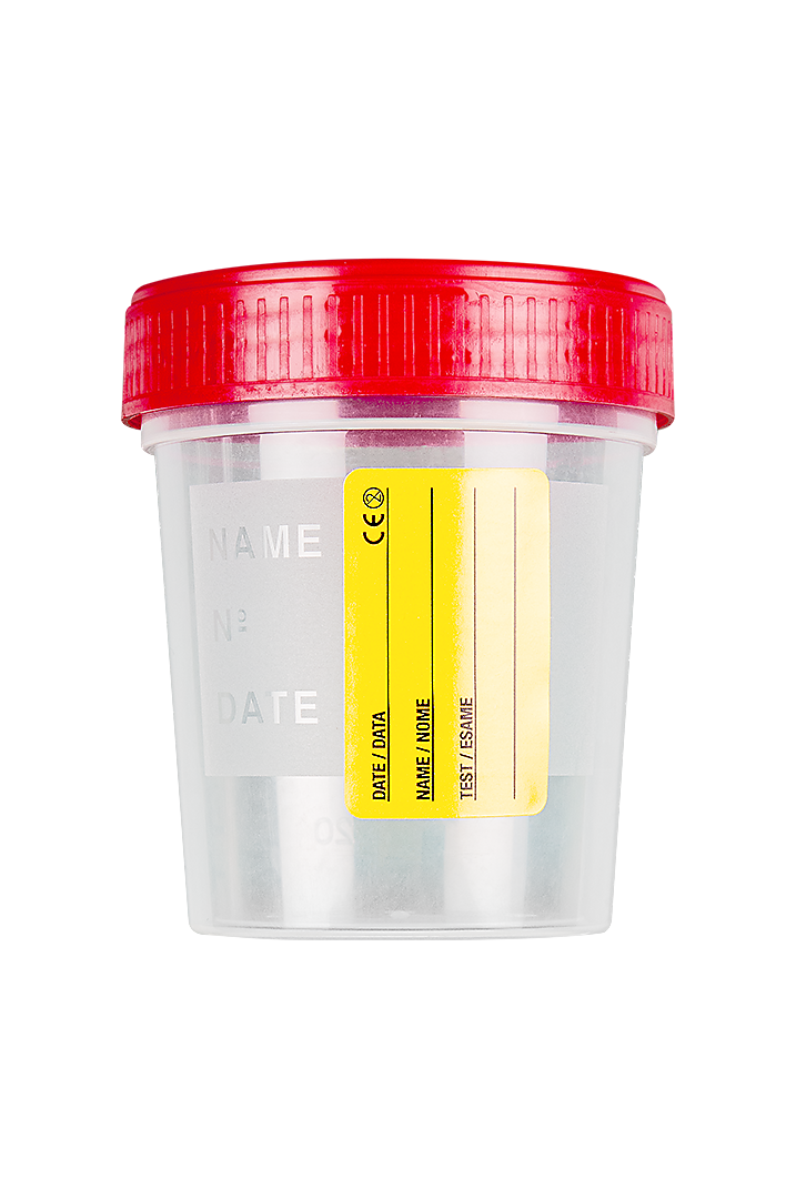 FL MEDICAL Promed contenitore urina 120 ml etichetta tappo vite