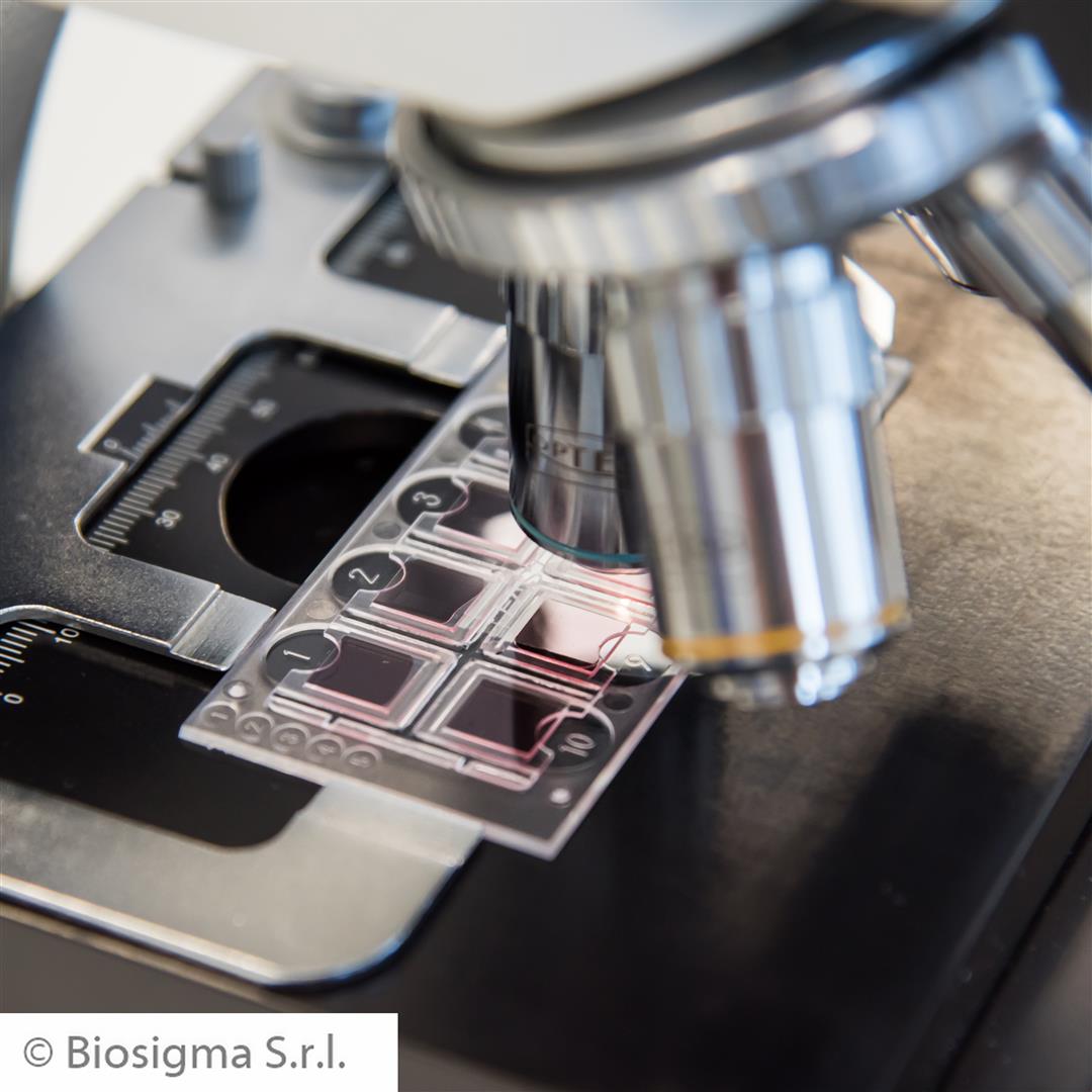 Biosigma Fast-Read 102 BVS100 kit urine 1000 determinazioni