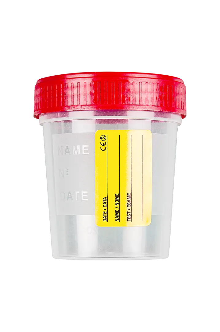 FL MEDICAL Promed contenitore urina 120 ml etichetta tappo vite