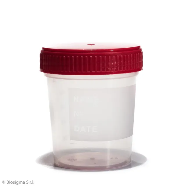 Biosigma BSC258 contenitore urine sterile 120 ml tappo rosso