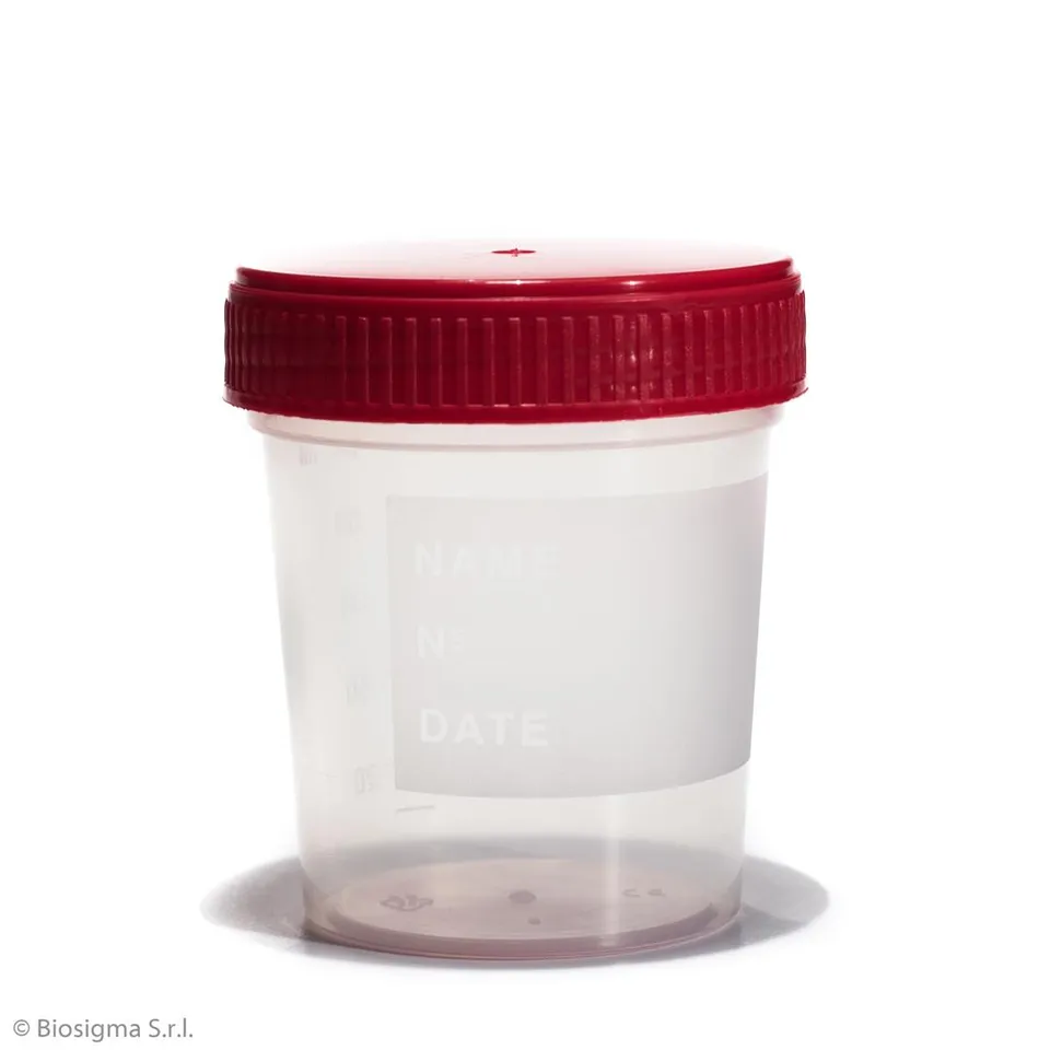 Biosigma BSC258 contenitore urine sterile 120 ml tappo rosso