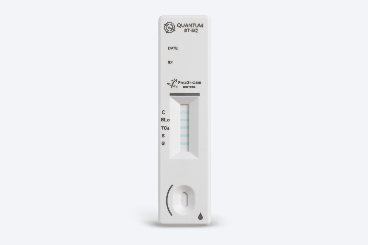 Prognosis Quantum BT-SQ test rapido laboratorio